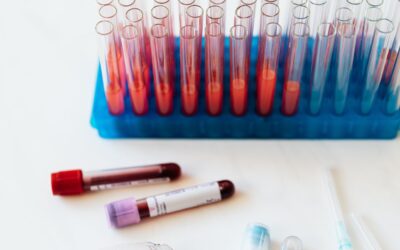 6 Reasons Why Everyone Should Get Regular Blood Tests
