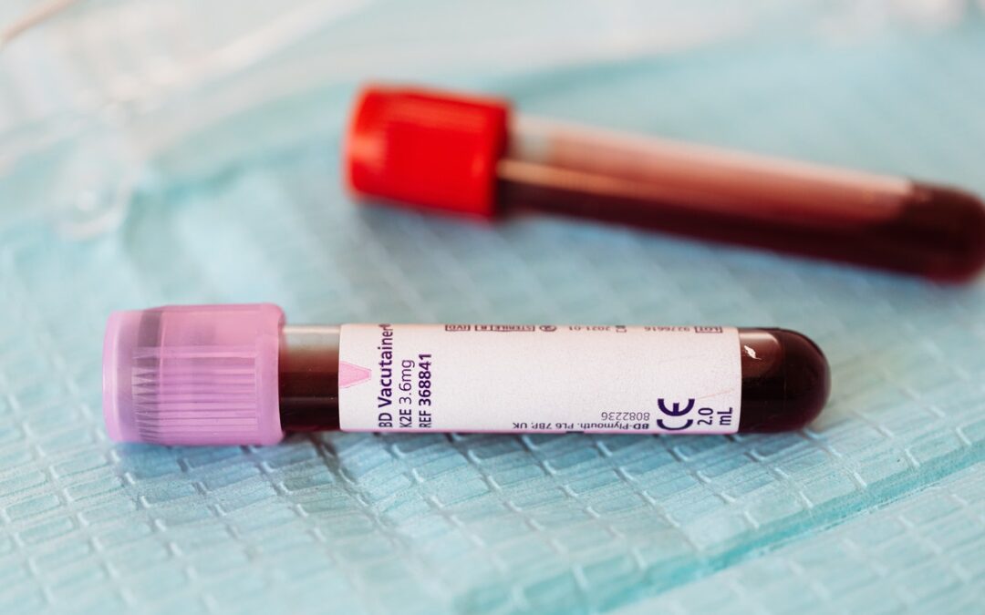 Which Blood Tests Require Fasting? What You Need to Know