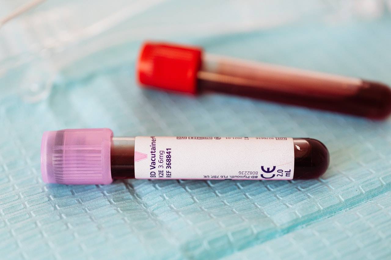 Which Blood Tests Require Fasting? What You Need to Know Family