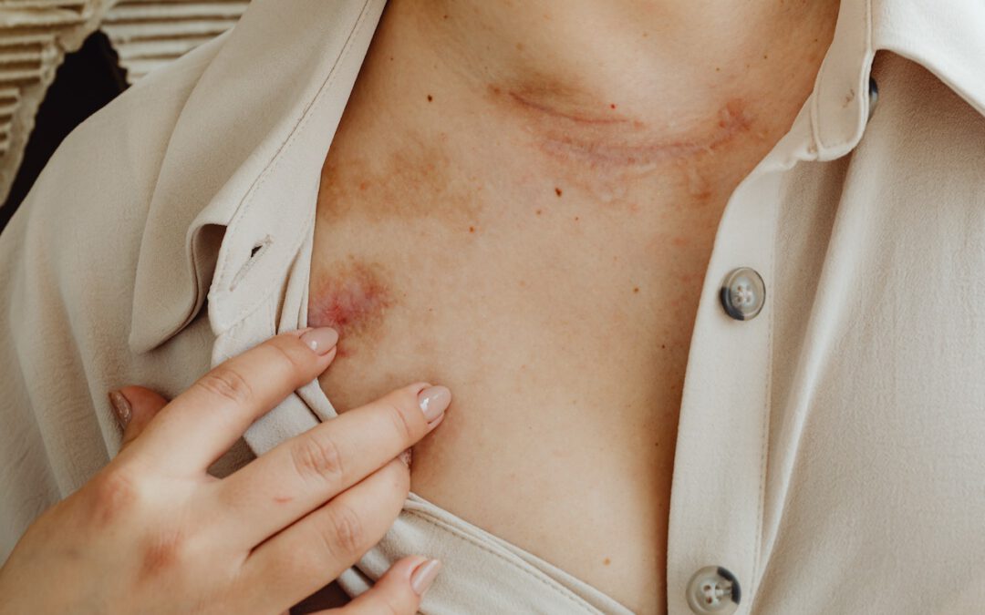 Common Skin Rashes: Symptoms and When to See a Doctor